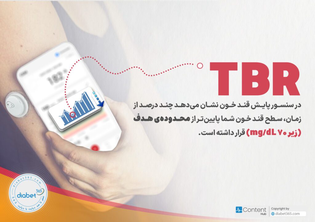 تفسیر گزارش سنسور پایش قند خون: TBR در سنسور پایش قند خون نشان می‌دهد چند درصد از زمان، سطح قند خون شما پایین‌تر از محدوده‌ی هدف (زیر ۷۰ mg/dL) قرار داشته است.