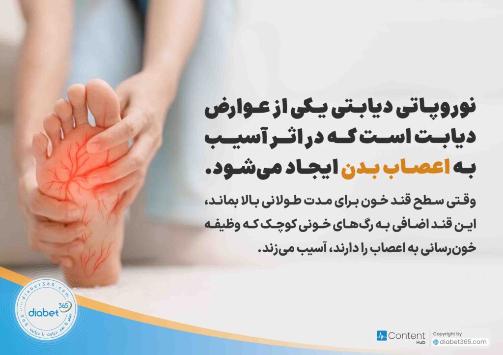 نوروپاتی دیابتی چیست و چه علائمی دارد؟ نوروپاتی دیابتی یکی از عوارض دیابت است که در اثر آسیب به اعصاب بدن ایجاد می‌شود. وقتی سطح قند خون برای مدت طولانی بالا بماند، این قند اضافی به رگ‌های خونی کوچک که وظیفه خون‌رسانی به اعصاب را دارند آسیب می‌زند.