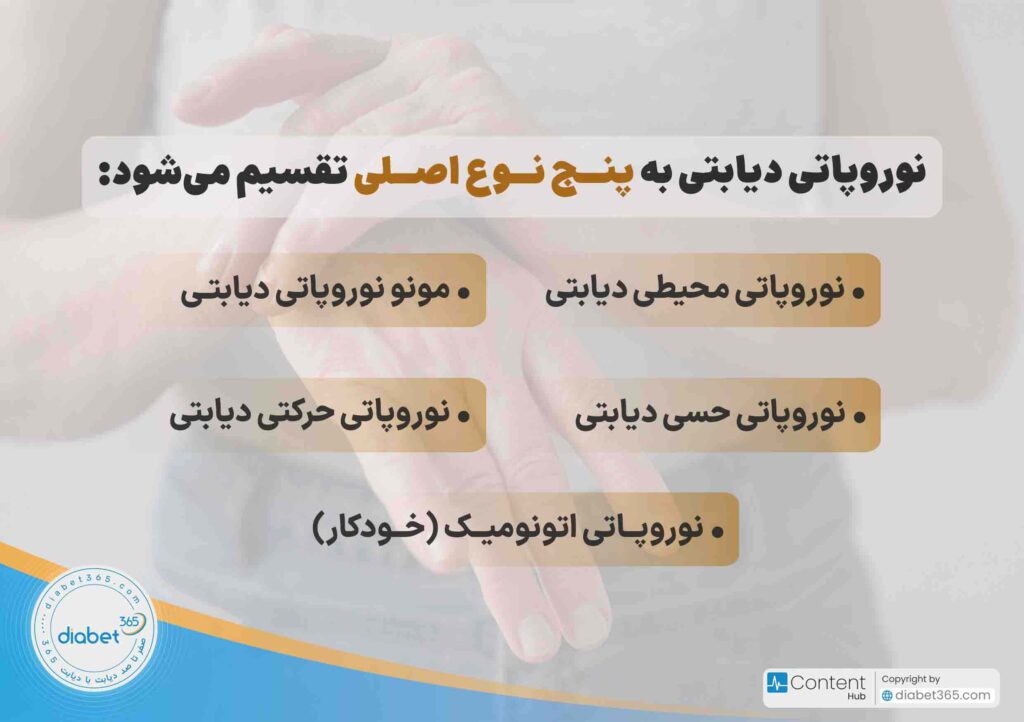 نوروپاتی دیابتی چیست و چه علائمی دارد؟ نوروپاتی دیابتی به چهار نوع اصلی تقسیم می‌شود: • نوروپاتی محیطی دیابتی • نوروپاتی حسی دیابتی • نوروپاتی اتونومیک (خودکار) دیابتی • نوروپاتی حرکتی دیابتی • مونو نوروپاتی دیایبتی