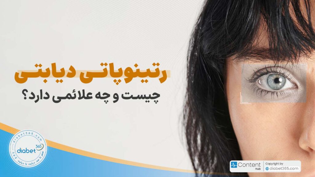 رتینوپاتی دیابتی چیست و چه علائمی دارد؟