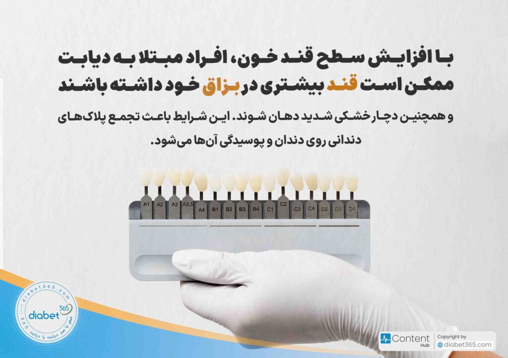 آیا دیابت به سلامت دهان و دندان آسیب می‌زند؟ با افزایش سطح قند خون، افراد مبتلا به دیابت ممکن است قند بیشتری در بزاق خود داشته باشند و همچنین دچار خشکی شدید دهان شوند. این شرایط باعث تجمع پلاک‌های دندانی روی دندان‌ و پوسیدگی آن‌ها می‌شود.