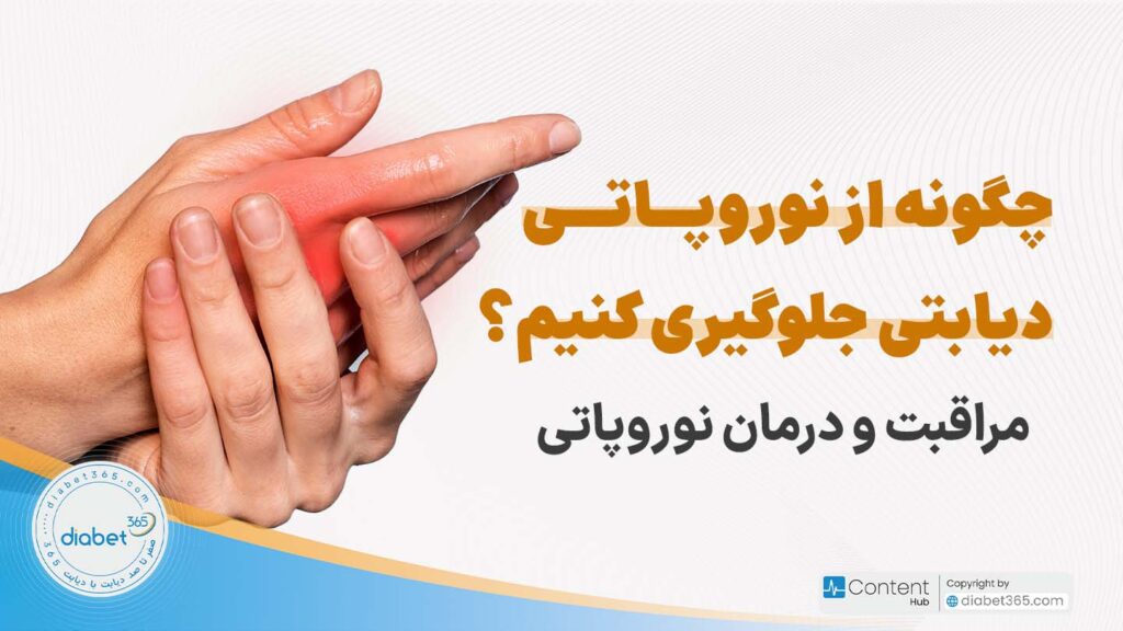 چگونه از نوروپاتی دیابتی جلوگیری کنیم؟ مراقبت و درمان نوروپاتی