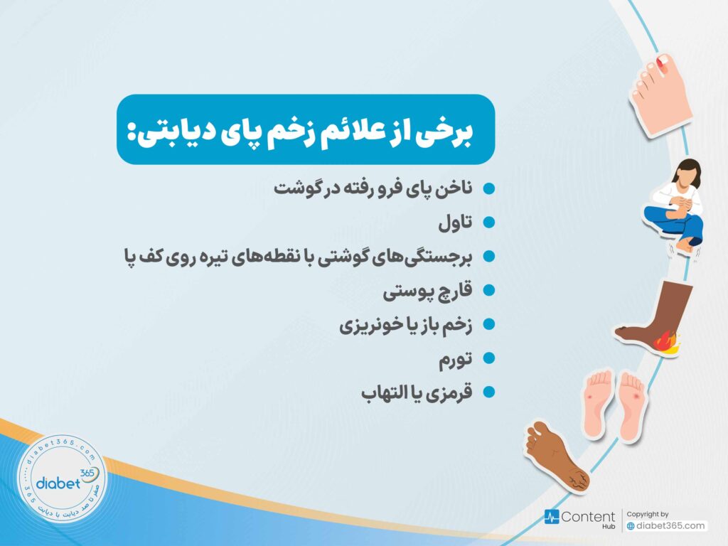 چگونه از زخم پای دیابتی جلوگیری کنیم؟: برخی علائم زخم پای دیابتی: ناخن پای فرو رفته در گوشت، تاول، برجستگیهای گوشتی با نقطههای تیره روی کف پا، قارچ پوستی، زخم باز یا خونریزی،تورم، قرمزی یا التهاب