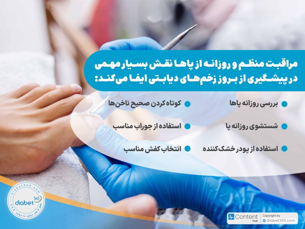 چگونه از زخم پای دیابتی جلوگیری کنیم؟: بررسی روزانه پاها شستشوی روزانه پا استفاده از پودر خشککننده کوتاه کردن صحیح ناخنها استفاده از جوراب مناسب انتخاب کفش مناسب