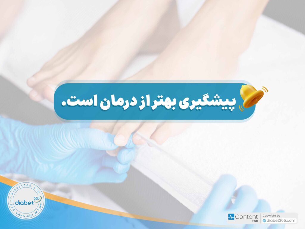 چگونه از زخم پای دیابتی جلوگیری کنیم؟: پیشگیری بهتر از درمان است