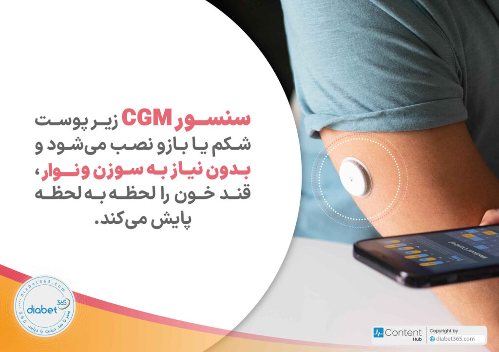 CGM بدون نیاز به سوزن و کیتهای معمول، از طریق سنسوری که به طور لحظهای و مداوم، قند خون شما را اندازه میگیرد.