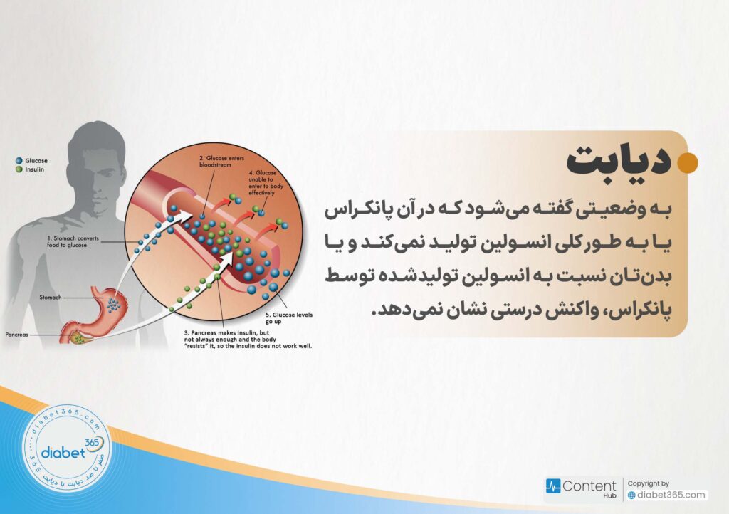 دیابت نوع 1 و 2 چه تفاوتی دارند؟: دیابت به وضعیتی گفته میشود که در آن پانکراس یا به طور کلی انسولین تولید نمیکند و یا بدنتان نسبت به انسولین تولیدشده توسط پانکراس، واکنش درستی نشان نمیدهد.