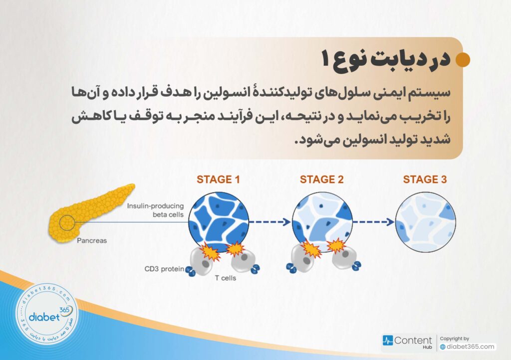 دیابت نوع 1 و 2 چه تفاوتی دارند؟: در دیابت نوع ۱، سیستم ایمنی سلولهای تولیدکنندۀ انسولین را هدف قرار داده و آنها را تخریب مینماید و در نتیحه، این فرآیند منجر به توقف یا کاهش شدید تولید انسولین میشود.