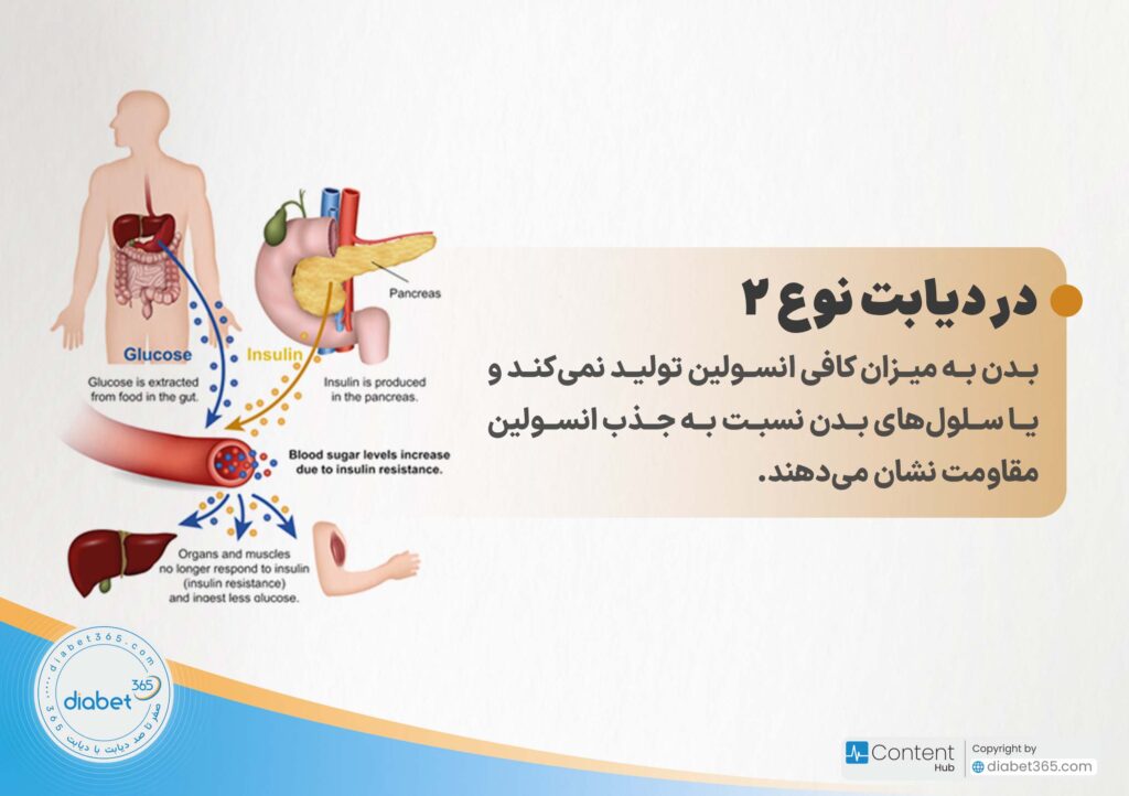 دیابت نوع 1 و 2 چه تفاوتی دارند؟: در دیابت نوع ۲، بدن به میزان کافی انسولین تولید نمیکند و یا سلولهای بدن نسبت به جذب انسولین مقاومت نشان میدهند.