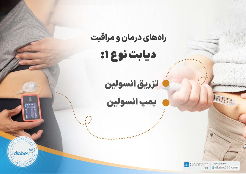دیابت نوع 1 و 2 چه تفاوتی دارند؟: راههای درمان و مراقبت دیابت نوع ۱: تزریق انسولین پمپ انسولین