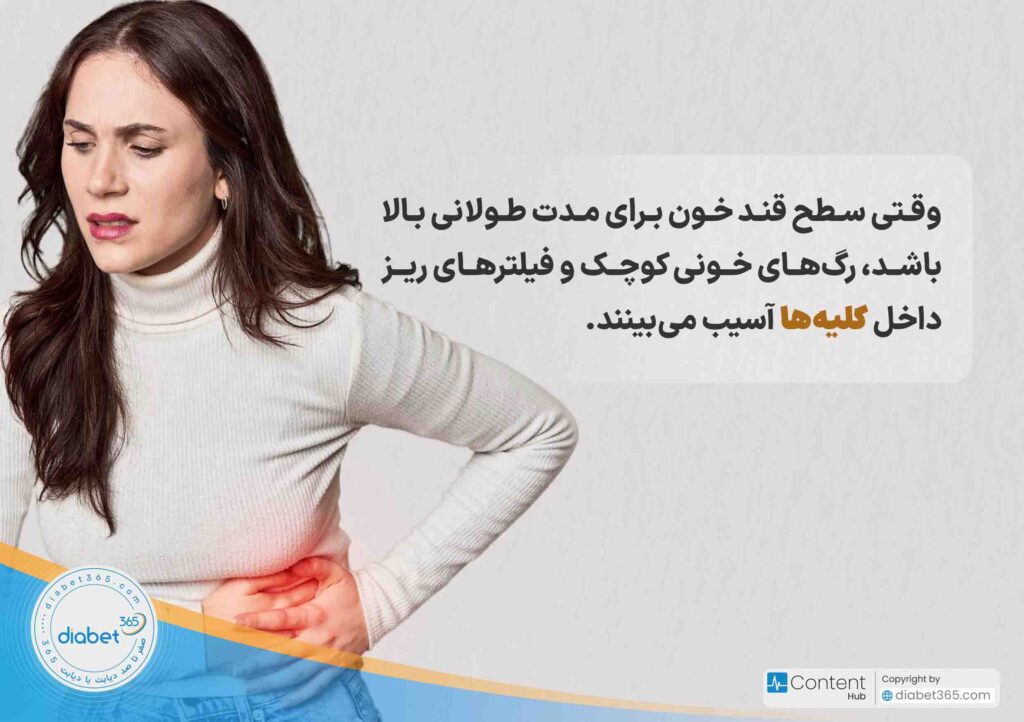 عوارض دیابت چیست؟وقتی سطح قند خون برای مدت طولانی بالا باشد، رگهای خونی کوچک و فیلترهای ریز داخل کلیهها آسیب میبینند.