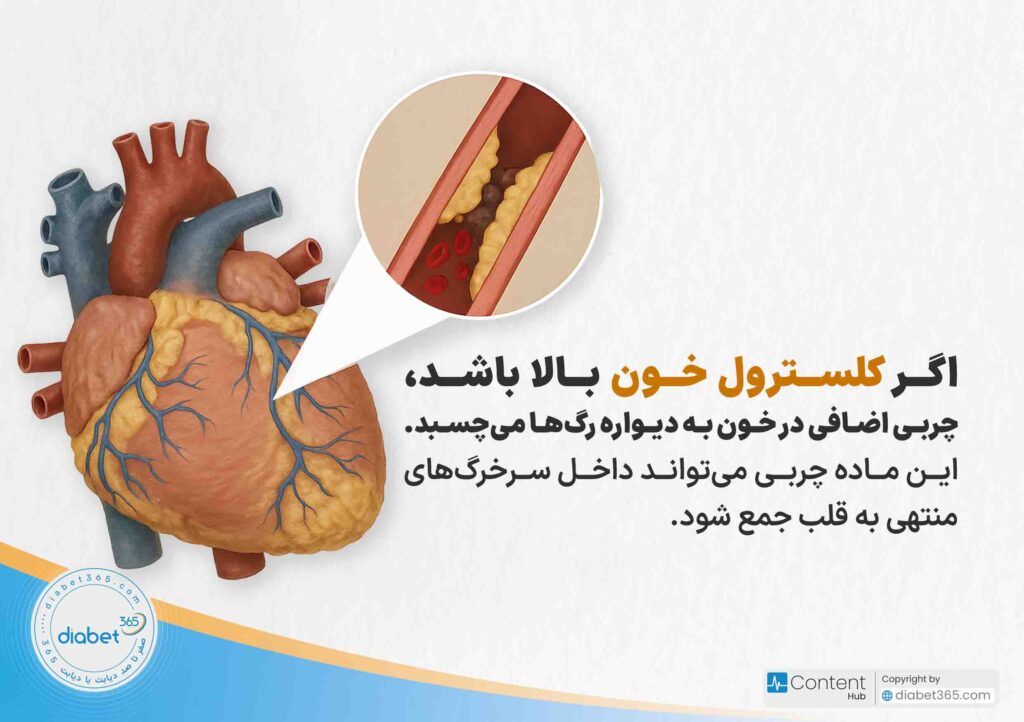 حمله قلبی دیابتی چیست و چه علائمی دارد؟ اگر کلسترول خون بالا باشد، چربی اضافی در خون به دیواره رگها میچسبد. این ماده چربی میتواند داخل سرخرگهای منتهی به قلب جمع شود.