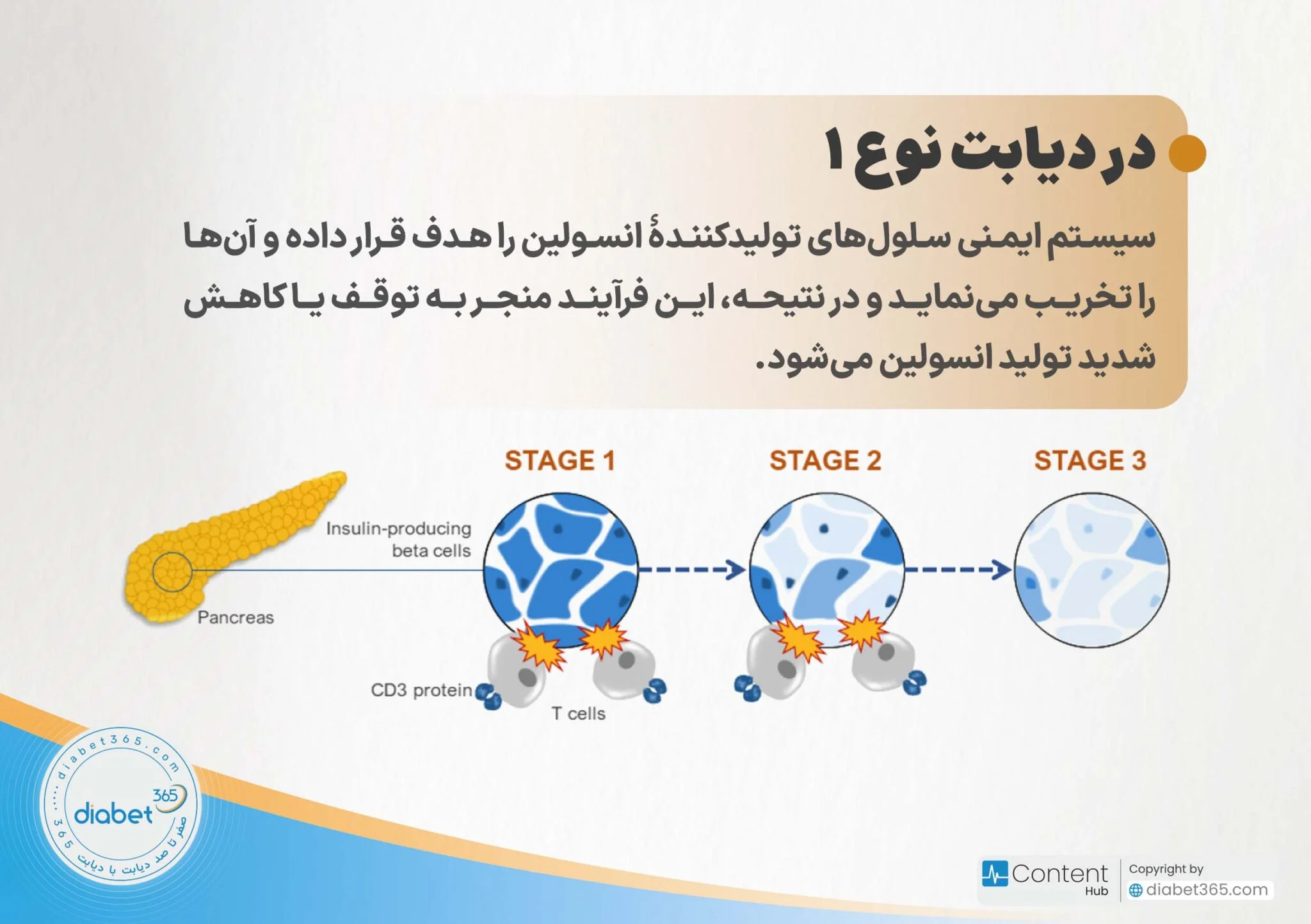دیابت نوع ۱ و ۲ چه تفاوتی دارند؟