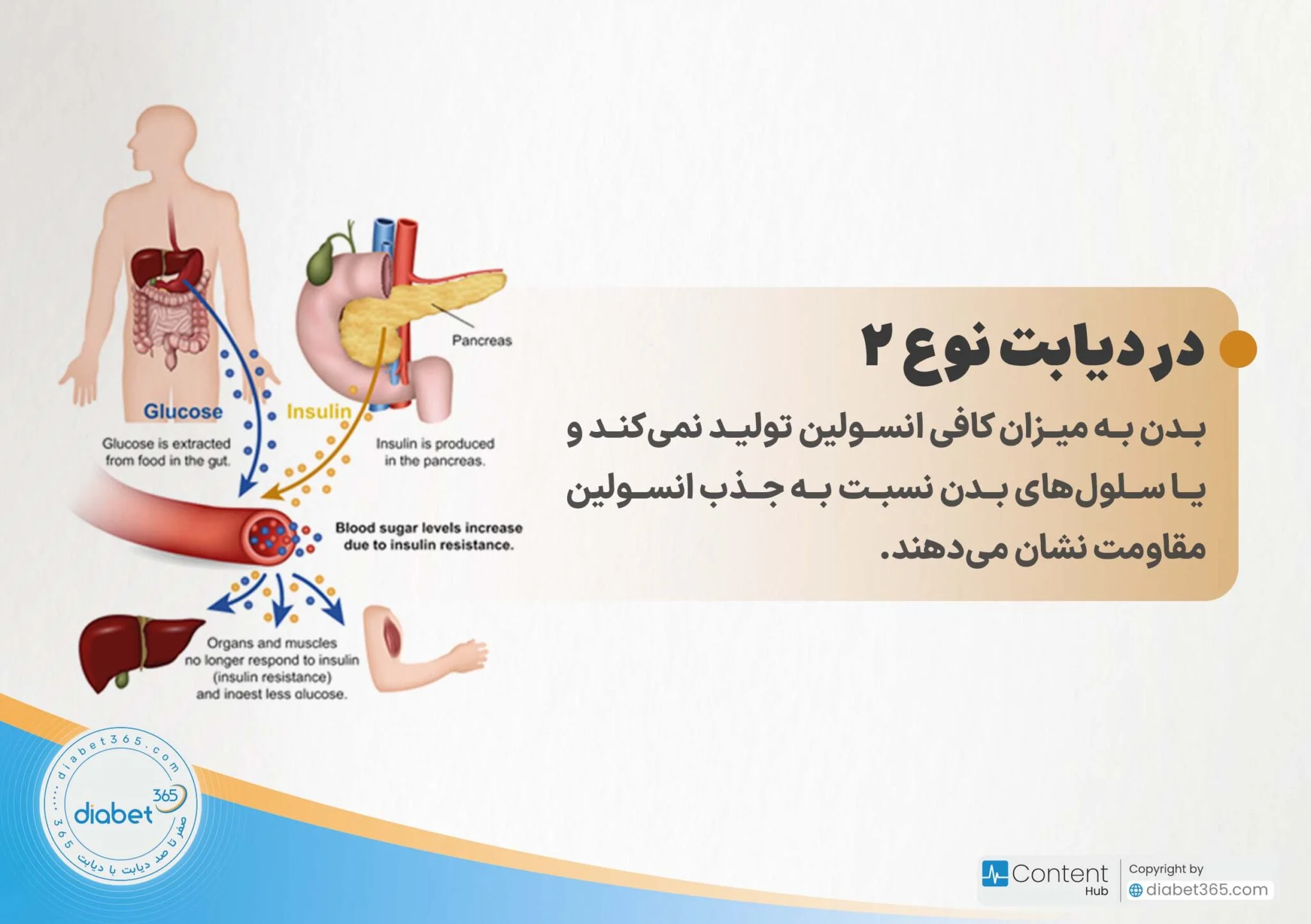 دیابت نوع ۱ و ۲ چه تفاوتی دارند؟