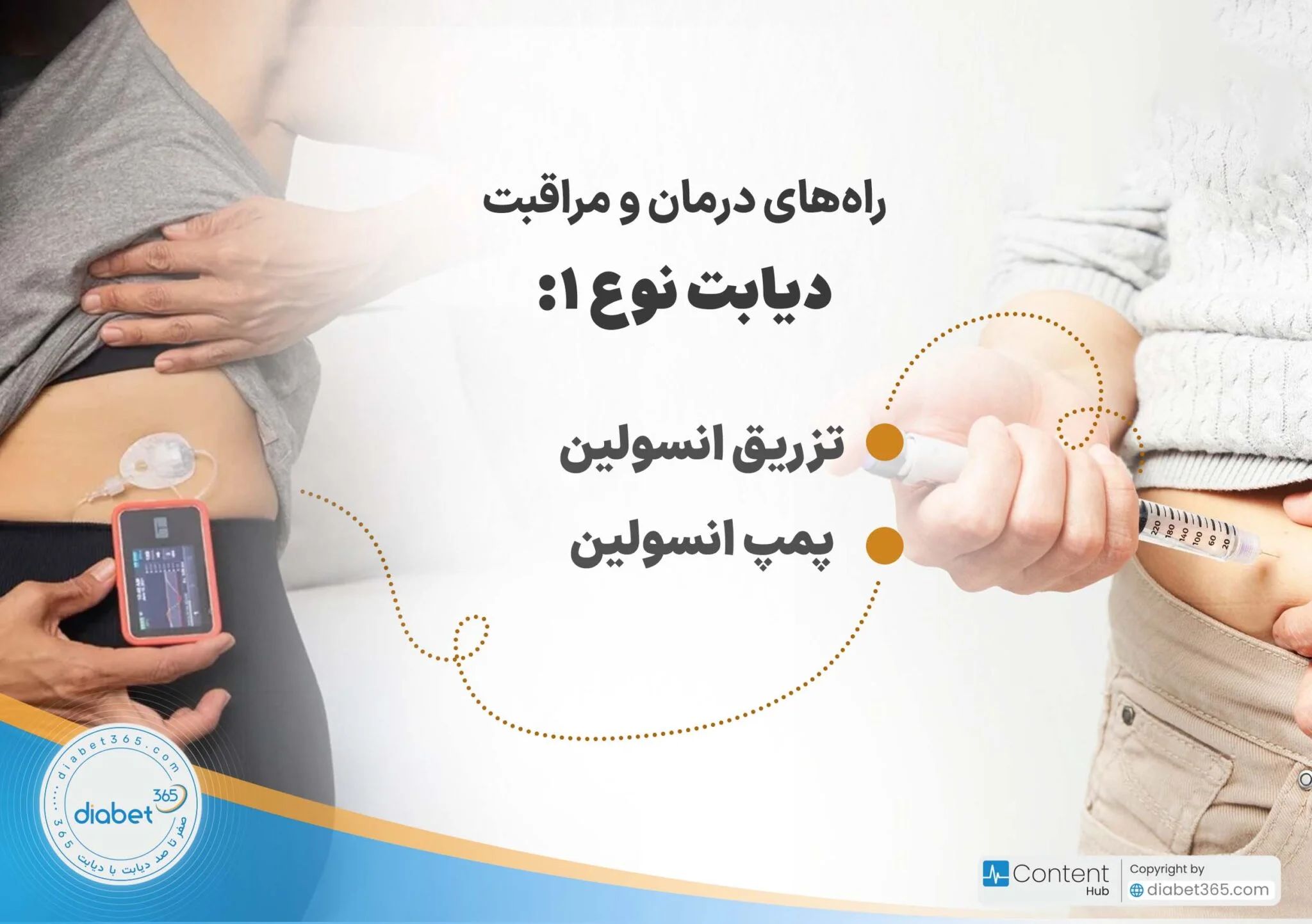دیابت نوع ۱ و ۲ چه تفاوتی دارند؟