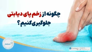 چگونه از زخم پای دیابتی جلوگیری کنیم؟