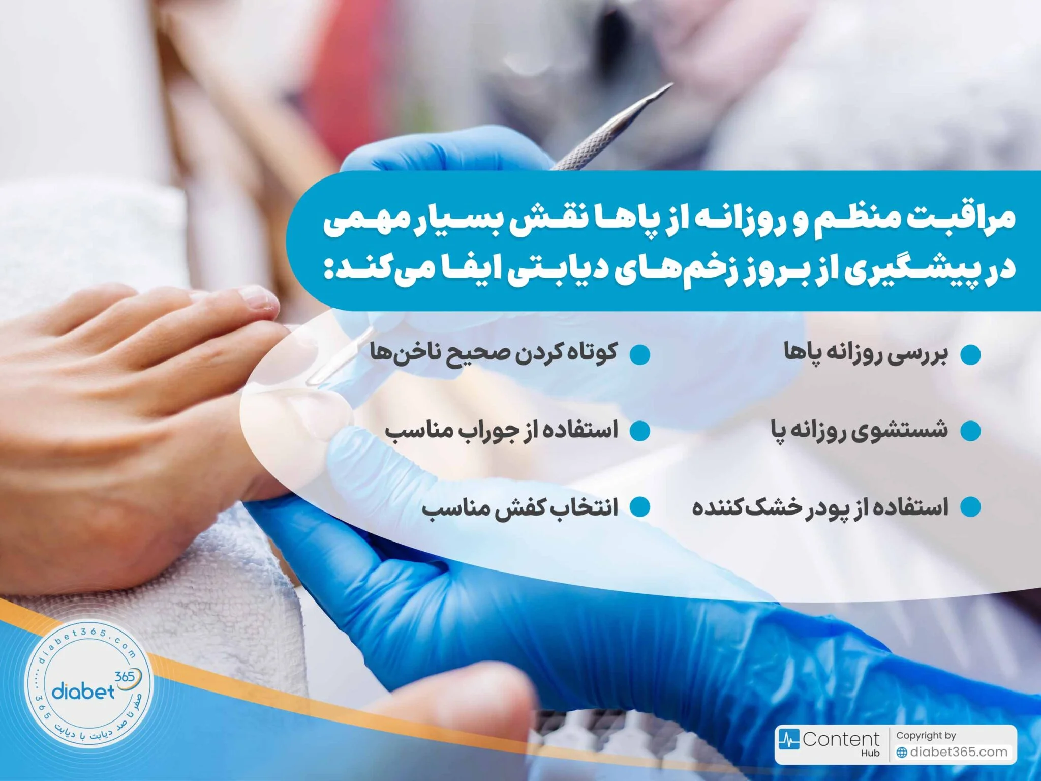 چگونه از زخم پای دیابتی جلوگیری کنیم؟