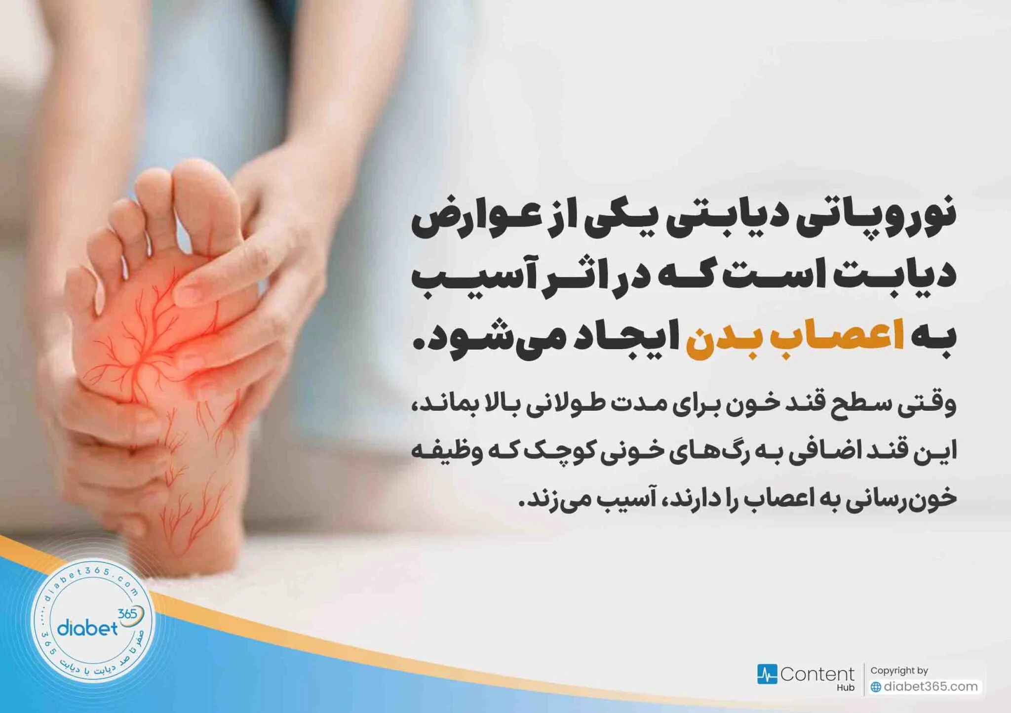 نوروپاتی دیابتی چیست و چه علائمی دارد؟