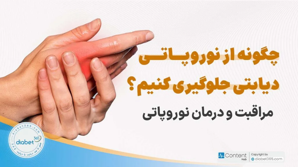 چگونه از نوروپاتی دیابتی جلوگیری کنیم؟ مراقبت و درمان نوروپاتی